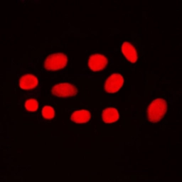 Anti-ADA2a antibody used in Immunocytochemistry/ Immunofluorescence (ICC/IF). GTX55173
