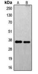 Anti-FAIM2 antibody used in Western Blot (WB). GTX55195