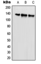 Anti-SCAF1 antibody used in Western Blot (WB). GTX55206