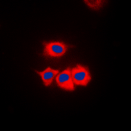Anti-Casein Kinase 1 gamma antibody used in Immunocytochemistry/ Immunofluorescence (ICC/IF). GTX55230