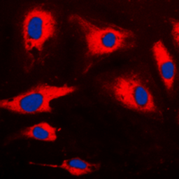 Anti-CARD14 antibody used in Immunocytochemistry/ Immunofluorescence (ICC/IF). GTX55231