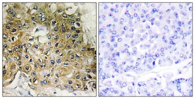 Anti-Integrin beta 1 / CD29 (phospho Thr789) antibody used in IHC (Paraffin sections) (IHC-P). GTX55308