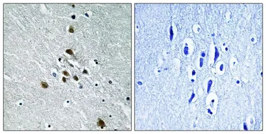 Anti-Splicing factor 1 (phospho Ser82) antibody used in IHC (Paraffin sections) (IHC-P). GTX55309