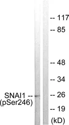 Anti-SNAI1 (phospho Ser246) antibody used in Western Blot (WB). GTX55326