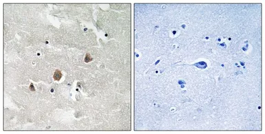 Anti-MAP3K1 (phospho Thr1400) antibody used in IHC (Paraffin sections) (IHC-P). GTX55333