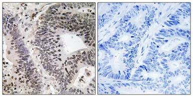 Anti-WWOX (phospho Tyr33) antibody used in IHC (Paraffin sections) (IHC-P). GTX55345