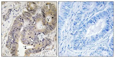 Anti-CAD (phospho Thr456) antibody used in IHC (Paraffin sections) (IHC-P). GTX55350