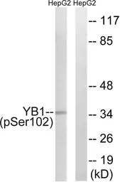 Anti-YB1 (phospho Ser102) antibody used in Western Blot (WB). GTX55373