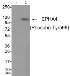 Anti-EphA4 (phospho Tyr596) antibody used in Western Blot (WB). GTX55376