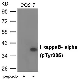 Anti-IKB alpha (phospho Tyr305) antibody used in Western Blot (WB). GTX55428