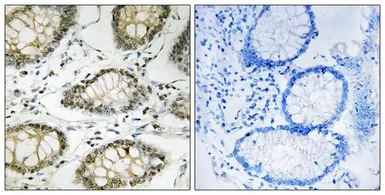 Anti-ATR (phospho Ser428) antibody used in IHC (Paraffin sections) (IHC-P). GTX55440