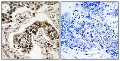 Anti-NUDC (phospho Ser326) antibody used in IHC (Paraffin sections) (IHC-P). GTX55448