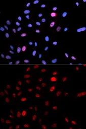 Anti-SMC1 (phospho Ser957) antibody used in Immunocytochemistry/ Immunofluorescence (ICC/IF). GTX55474