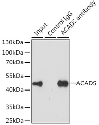 Anti-ACADS antibody used in Immunoprecipitation (IP). GTX55489