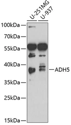 Anti-ADH5 antibody used in Western Blot (WB). GTX55494