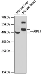 Anti-AIPL1 antibody used in Western Blot (WB). GTX55497