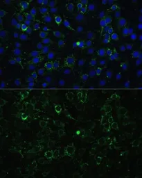 Anti-ALDH1A2 antibody used in Immunocytochemistry/ Immunofluorescence (ICC/IF). GTX55501