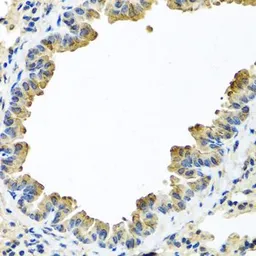 Anti-alpha 1 Antichymotrypsin antibody used in IHC (Paraffin sections) (IHC-P). GTX55503