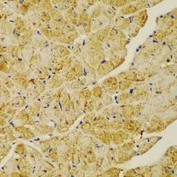 Anti-alpha Actinin 1 antibody used in IHC (Paraffin sections) (IHC-P). GTX55505