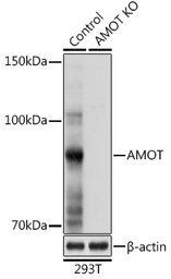 Anti-AMOT antibody used in Western Blot (WB). GTX55509
