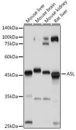 Anti-ASL antibody used in Western Blot (WB). GTX55520