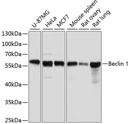 Anti-Beclin 1 antibody used in Western Blot (WB). GTX55535