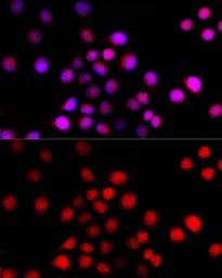 Anti-Beclin 1 antibody used in Immunocytochemistry/ Immunofluorescence (ICC/IF). GTX55535