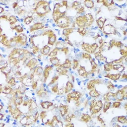 Anti-Beclin 1 antibody used in IHC (Paraffin sections) (IHC-P). GTX55535
