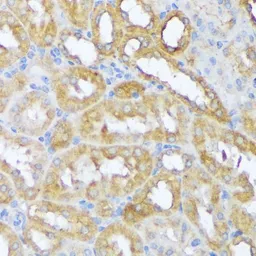 Anti-Beclin 1 antibody used in IHC (Paraffin sections) (IHC-P). GTX55535