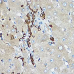 Anti-Calpain 2 antibody used in Immunocytochemistry/ Immunofluorescence (ICC/IF). GTX55545