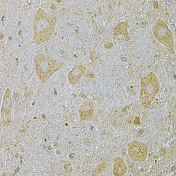 Anti-CaMKI gamma antibody used in IHC (Paraffin sections) (IHC-P). GTX55546