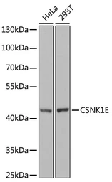 Anti-Casein Kinase 1 epsilon antibody used in Western Blot (WB). GTX55549