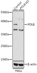 Anti-DNA polymerase beta antibody used in Western Blot (WB). GTX55594