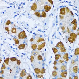 Anti-DNA polymerase beta antibody used in IHC (Paraffin sections) (IHC-P). GTX55594