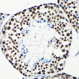 Anti-EFTUD2 antibody used in IHC (Paraffin sections) (IHC-P). GTX55602