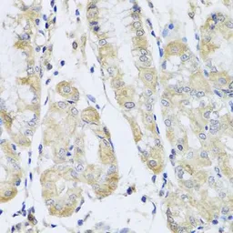 Anti-FANCA antibody used in IHC (Paraffin sections) (IHC-P). GTX55613
