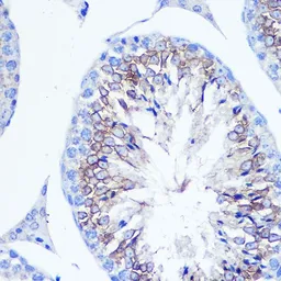 Anti-Fascin 1 antibody used in IHC (Paraffin sections) (IHC-P). GTX55616