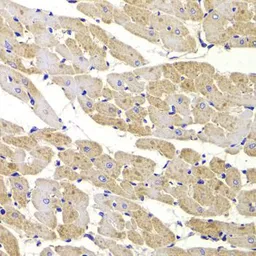 Anti-FIS1 antibody used in IHC (Paraffin sections) (IHC-P). GTX55624