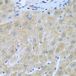 Anti-Furin antibody used in IHC (Paraffin sections) (IHC-P). GTX55628