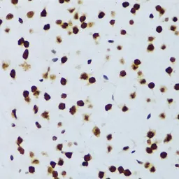 Anti-FUS antibody used in IHC (Paraffin sections) (IHC-P). GTX55629