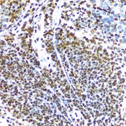 Anti-FUS antibody used in IHC (Paraffin sections) (IHC-P). GTX55629