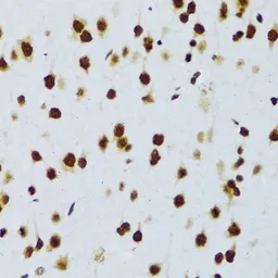 Anti-FUS antibody used in IHC (Paraffin sections) (IHC-P). GTX55629