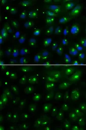 Anti-GGA2 antibody used in Immunocytochemistry/ Immunofluorescence (ICC/IF). GTX55637