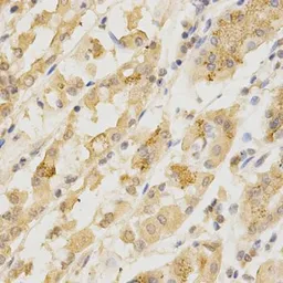 Anti-GGA2 antibody used in IHC (Paraffin sections) (IHC-P). GTX55637