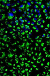 Anti-Grp75 antibody used in Immunocytochemistry/ Immunofluorescence (ICC/IF). GTX55649