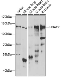 Anti-HDAC7 antibody used in Western Blot (WB). GTX55655