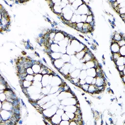 Anti-Hexokinase II antibody used in IHC (Paraffin sections) (IHC-P). GTX55657