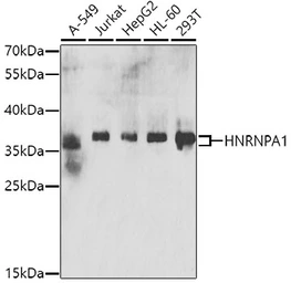 Anti-hnRNP A1 antibody used in Western Blot (WB). GTX55663