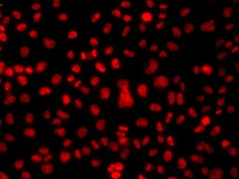 Anti-hnRNP A1 antibody used in Immunocytochemistry/ Immunofluorescence (ICC/IF). GTX55663