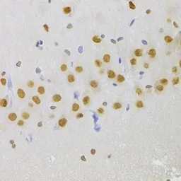 Anti-hnRNP A1 antibody used in IHC (Paraffin sections) (IHC-P). GTX55663